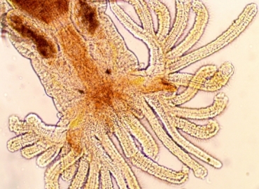 front end of a bristle worm 